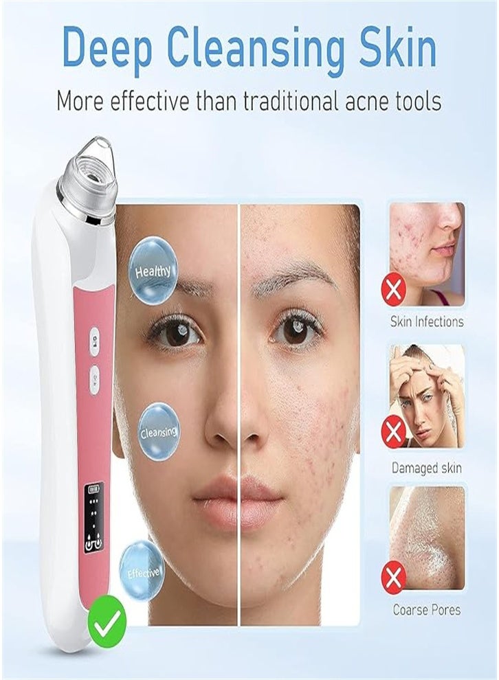 New Blackhead Remover, Pore Vacuum Cleaner, Blackhead Extraction Tool with Camera, Pore Cleaner for Men and Women, 3 Adjustment Modes and 6 Suction Heads (Pink) - Image 4