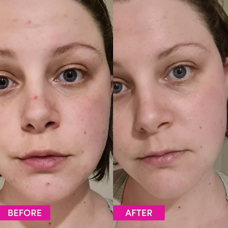 Sand & Sky Australian Glow Berries Brightening Moisturizer with Vitamin C & Squalane - Glow-Boosting Face Cream, Anti-Aging Formula, For Dull Skin - Image 2