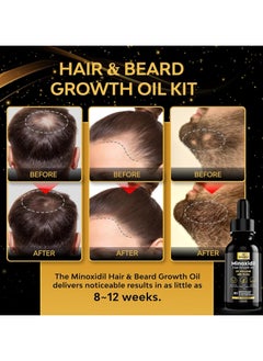 beaueli Minoxidil , Hair Loss Treatments , Minoxidil 5%  - Image 4