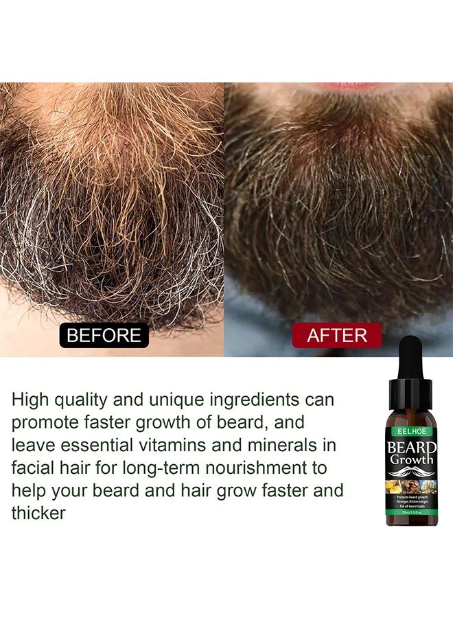 EELHOE Beard Growth Oil, Essential Oil Anti Hair Loss Product Natural Mustache Regrowth Oil For Men Nourishing Beard Care Roller 30ml - Image 5