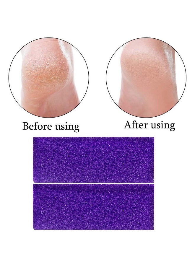 Tailpa - 40 Pcs Pumice Stone For Feet Foot Scrubber Sponge For Feet Care And Callus Remover Mini Disposable Pumice Pads For Dead Skin Remover (Purple) - Image 1