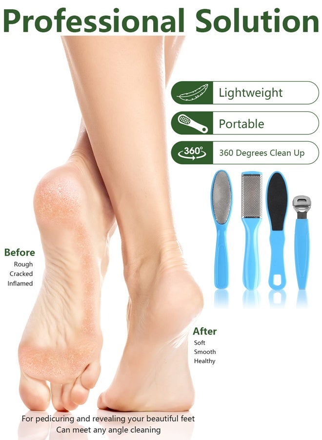 بونيتو مجموعة أدوات العناية بالقدمين الاحترافية 20 في 1، مجموعة أدوات العناية بالقدمين الاحترافية، مجموعة أدوات العناية بالقدمين من الفولاذ المقاوم للصدأ، مجموعة أدوات إزالة الجلد الميت للرجال والنساء للرجال أو النساء أفضل هدية منزلية (أزرق) - Image 3
