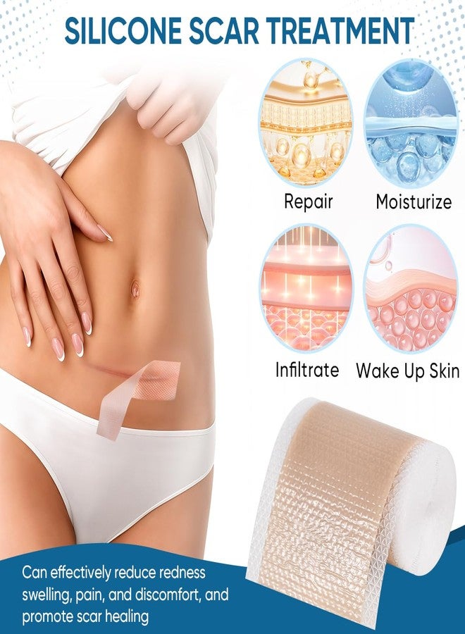 KISEER Silicone Scar Sheets 1.6 x 60 Inch Roll Silicone Scar Removal Tape Strips for Surgical Scars Removal Treatment, C-Section, Keloid, Burns, Acne, Tummy Tuck - Image 5