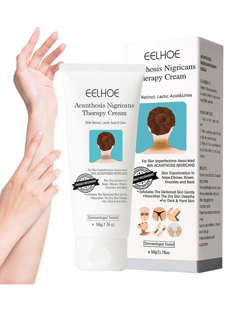 EELHOE كريم مصحح للبقع الداكنة - مصحح لإزالة الأكثانوسيس النيجرينس للوجه - 50 جرام مبيض للبشرة للجسم للنساء للمرفق والركبة والكاحل والرقبة كريم مصحح للبقع الداكنة - Image 2