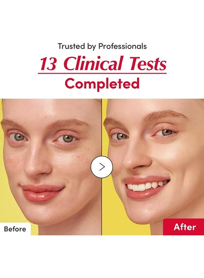 إيكوالبيري سيروم الفيتامينات المضيئة - سيروم فيتامين سي المشرق مع النياسيناميد | يعزز حاجز الجلد | يرطب باستخدام السيراميد وحمض الهيالورونيك، 1.01 أونصة / 30 مل - Image 5