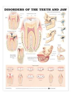 Disorders of the Teeth and Jaw Anatomical Chart  - Image 1
