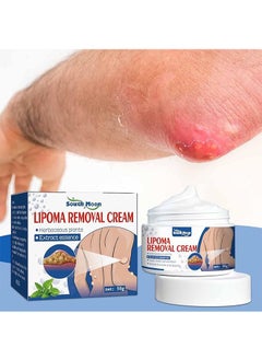 SOUTH MOON Lipoma Removal Cream 50g，Friendly Lipoma Treatment Cellulite Cream for Lipolysis Fat Lump Removal and Nodular Discomfort for Body and Face  - Image 1