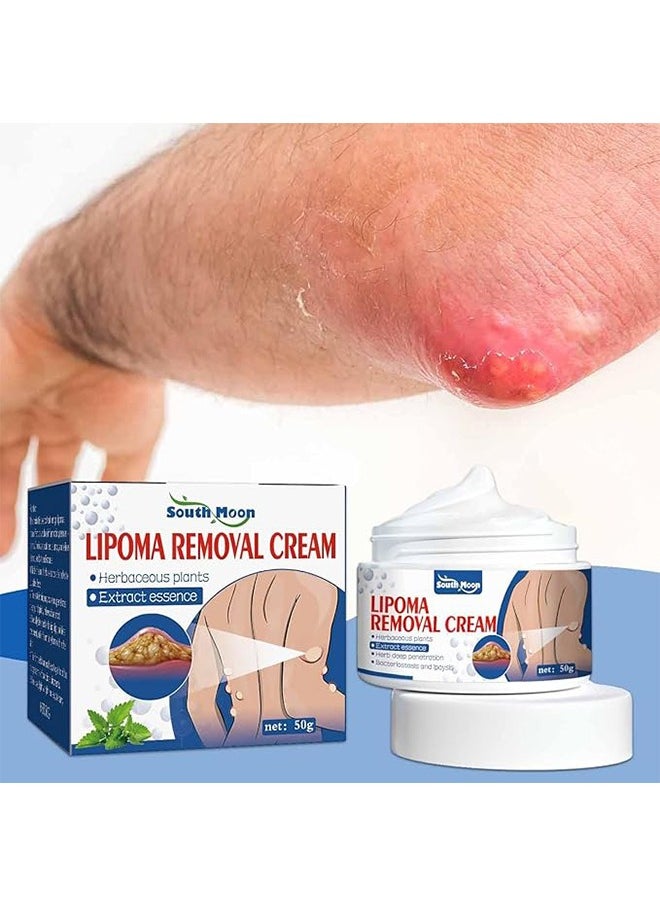 SOUTH MOON Lipoma Removal Cream 50g，Friendly Lipoma Treatment Cellulite Cream for Lipolysis Fat Lump Removal and Nodular Discomfort for Body and Face  - Image 1