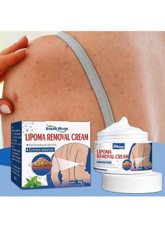 SOUTH MOON Lipoma Removal Cream 50g，Friendly Lipoma Treatment Cellulite Cream for Lipolysis Fat Lump Removal and Nodular Discomfort for Body and Face  - Image 2
