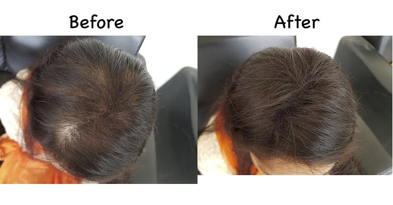 Fix-O-Fit FixOFit Hair Building Fibers Instant Hair Thickening Bald Spot Concealer Natural Finish Easy to Apply Wind Sweat Resistant Black 8g Pack of 1 - Image 4