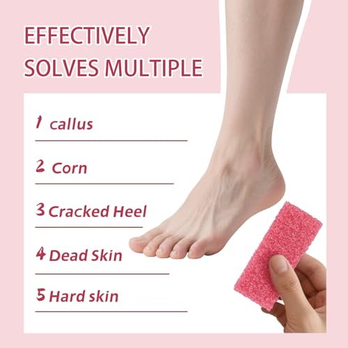 NOVAL Pumice Stone for Feet Scrubber Dead Skin Disposable Foot Pumice Foot Callus Remover Pedicure Tools Pink Pumice Sponge Nail Salon Home Use,40 PCS - Image 3