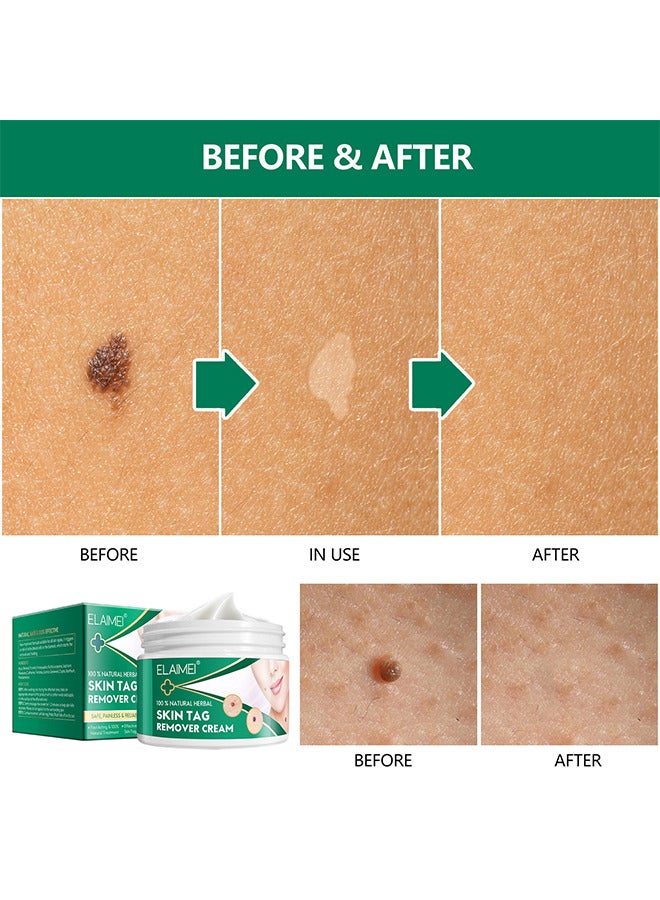 Elaimei Fast And Effective Skin Tag Remover Cream And Painless Natural Formula, Smoothes Skin Gentle Fast Acting Gel Wart Removal For Plantar Wart Flat Warts And Corns, 100 % Natural Herbal - Image 4