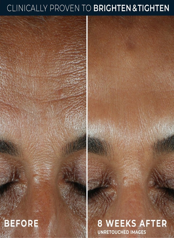 RoC سيروم فيتامين سي النشط 10% من روك مالتي كوريكشن ريفيف + جلو للوجه، علاج يومي لمكافحة الشيخوخة والتجاعيد وتوحيد لون البشرة، سيروم مبيض، 1 أونصة سائلة - Image 4