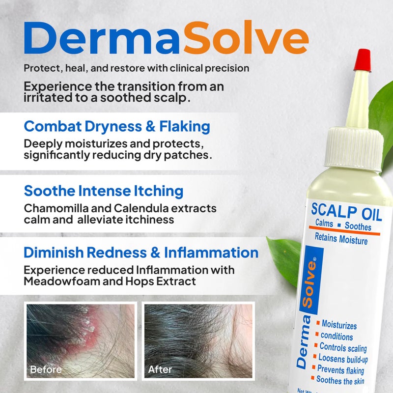 Dermasolve 4 oz Psoriasis, Seborrheic Dermatitis, & Dandruff Scalp Oil - Dermatologist Approved - Flaky Scalp Relief, Clinically Tested, Long-Lasting Itch-Free, High-Performance Formula - Image 2