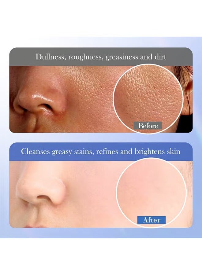 موويام منظف ​​حمض الساليسيليك - يحتوي على 2% من حمض الساليسيليك والسيراميد والنياسيناميد | غسول وجه رغوي لطيف للبشرة الحساسة والمعرضة لحب الشباب | تنظيف عميق للمسام | للجنسين - 80 جم/2.82 أونصة - Image 5