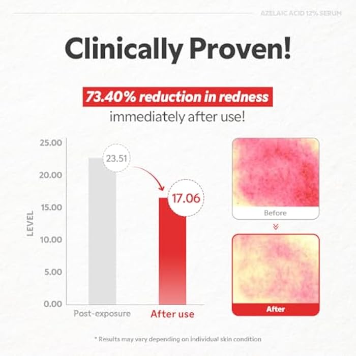 TIRTIR Azelaic Acid 12% Serum for Blemish-Prone Skin - Lightweight Hydrating Formula with Zinc PCA & Hyal-ZIP, Non-Comedogenic, Fragrance-Free, 30ml / 1.01 Fl Oz - Image 5