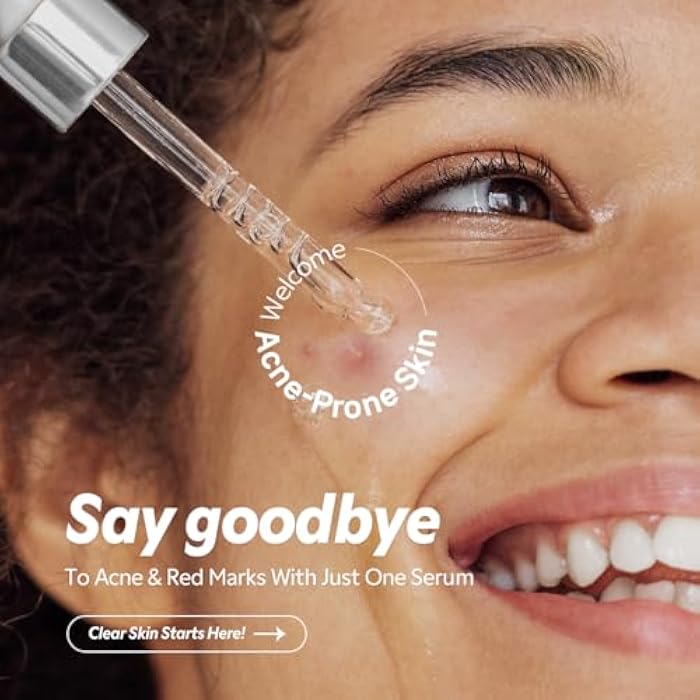 TIRTIR Azelaic Acid 12% Serum for Blemish-Prone Skin - Lightweight Hydrating Formula with Zinc PCA & Hyal-ZIP, Non-Comedogenic, Fragrance-Free, 30ml / 1.01 Fl Oz - Image 2