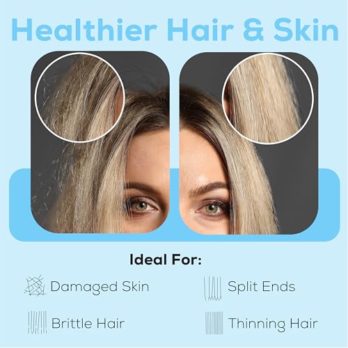 SparkPod 23 Stage Shower Head Filter for Dry Hair and Skin - High Output Universal Shower Filters to Remove Toxic Chemicals, Chlorine & Heavy Metals (Midnight Black Matte) - Image 2