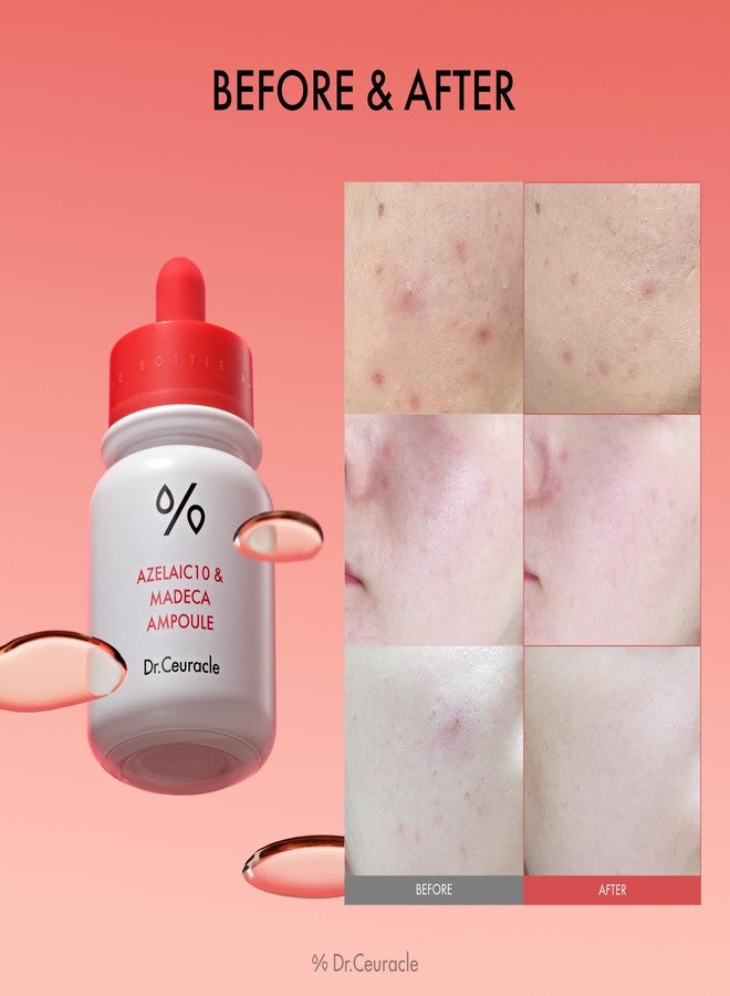leegeehaam Dr.Ceuracle Azelaic Acid 10 & Madecassoside Ampoule - Redness Relief and Soothing Serum for Sensitive Skin and Blemish-Prone Spot Care, Korean Skincare for Stocking Stuffers - Image 2