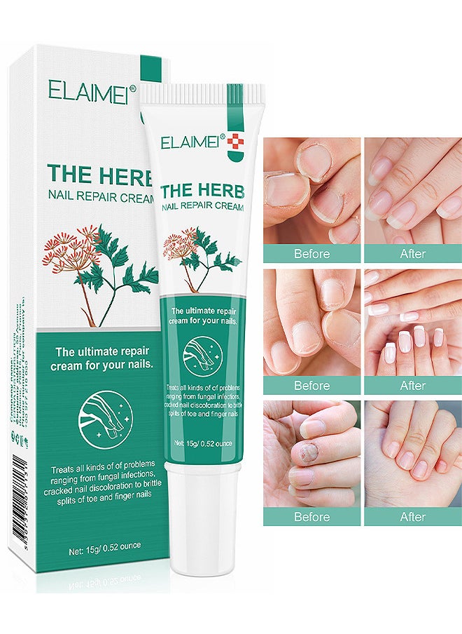 Elaimei Herb Nail Repair Cream, Nail Repair Essence Cream, Restores Appearance Of Discolored Or Damaged Nails, Toe Be Health Instant Beauty Cream For Toenail Care Under The Nail 15G  - Image 1