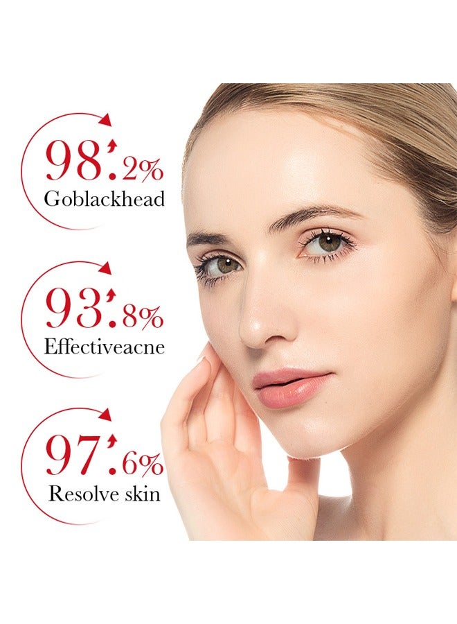 BIOAOUA Salicylic Acid Acne Removal Cream , Acne Treatment Face Cream, Acne Spot Treatment for Face & Acne Dots, Natural Cystic Acne Treatment, For All Skin Types, Premium Acne Scar Cream & Pimple Remover 20g - Image 2