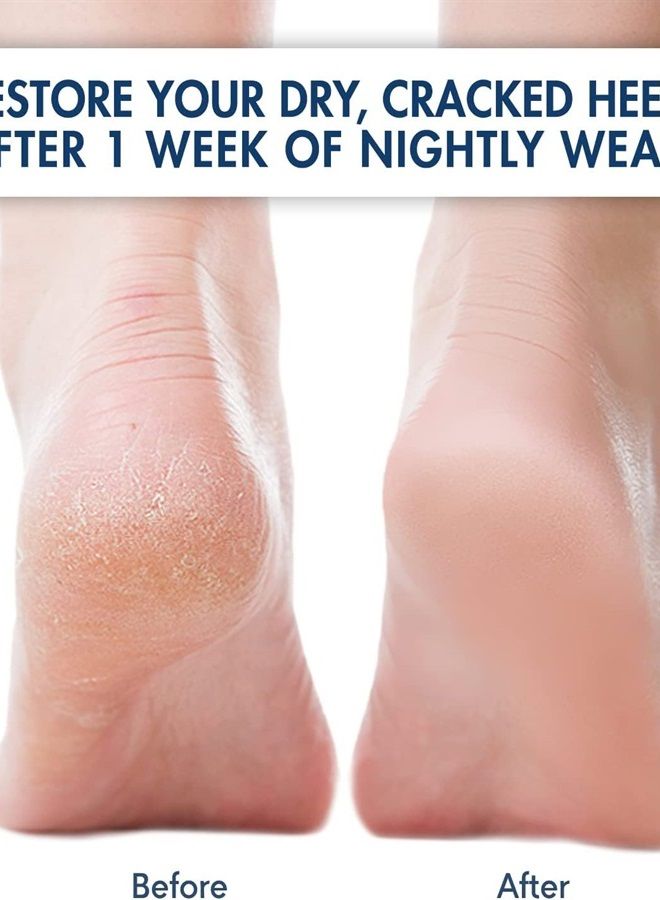 Dr. Frederick's Original Moisturizing Heel Socks for Cracked Heel Treatment - 2 Pairs - Stop Cracked Heels in Their Tracks - Image 2