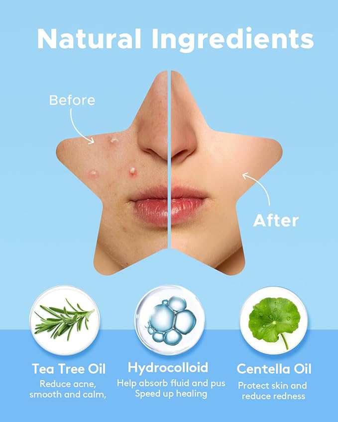 LitBear Acne Pimple Patch 6 Colors 168 Dots Star Pimple Patches with Case Tea Tree Oil Centella Oil Hydrocolloid Acne Pimple Patches for Face Cute Zit Patches Pimple Stickers Acne Dots - Image 3