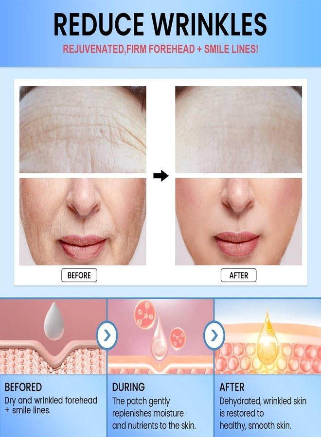 Tripsky Forehead Wrinkle Patches, Smile Line Patches, Wrinkle Patches Overnight Smoothing Facial Wrinkle Patch, Lift Lines for Women & Men (White - Image 5