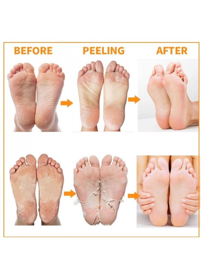 MBeauty Exfoliating Magic Foot Socks, Single Use 1 Pair Moisturizing Socks, Softens & Removes Dead Calluses - pack of 1 - Image 3