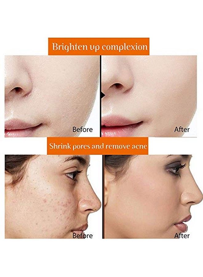 Quat Vitamin C With Vitamin E Face Serum For Face Whitening & Brightening 30Ml - Image 3