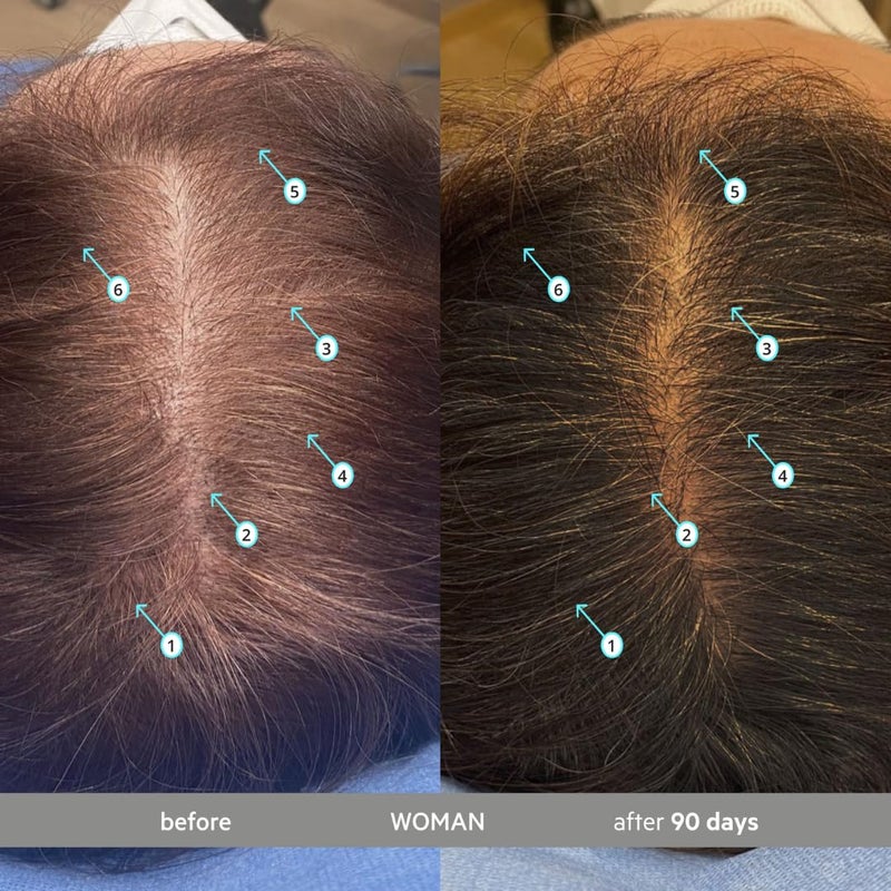 DS LABORATORIES DS Labs Spectral Extra Strength Hair Density Serum (formerly Spectral.DNC-S), 60mL - Lightweight Leave-In for Fuller, Thicker Looking Hair, Melanex Technology Preserves Pigment, For Men & Women - Image 4