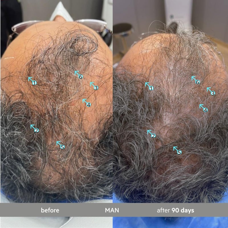 DS LABORATORIES DS Labs Spectral Extra Strength Hair Density Serum (formerly Spectral.DNC-S), 60mL - Lightweight Leave-In for Fuller, Thicker Looking Hair, Melanex Technology Preserves Pigment, For Men & Women - Image 3