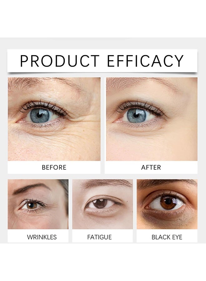 Dinkiss Lutein Eye Essence Oil, Vc Lutein Eye Essence Oil, Lutein Eye Serum, Lutein Eye Oil, Under Eye Oil Roller Ball, Japan Firming Anti-Aging Eye Serum For Eye Bags (8ml) - Image 2