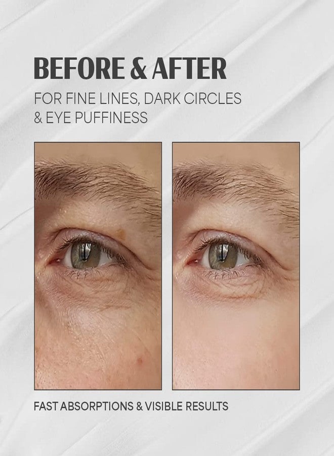 Proot Advanced Mens Eye Cream | Eye Bags Treatment for Men | Mens Eye Cream Anti Aging Bags & Dark Circle with High Concentrate of Natural Ingredients | Eye Cream for Men | Mens Under Eye Cream for Bags with Age-Defying Skincare Formula | Eye Bags Treatment for Men | Mens Eye Cream Formulated with Vitamin C, Witch Hazel and Other Natural Ingredients | 1.01 fl oz 30 ml - Image 2