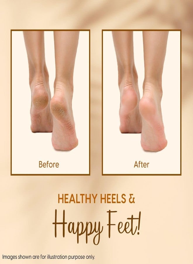 Matra Silicone Gel Heel Pad Socks (1 Pair) - Half Length, Moisturizing Socks with Vented Design - Unisex Anti-Crack Heel Repair Socks & Foot Protector for Dry Cracked Heels & Pain Relief (Free Size) - Image 5