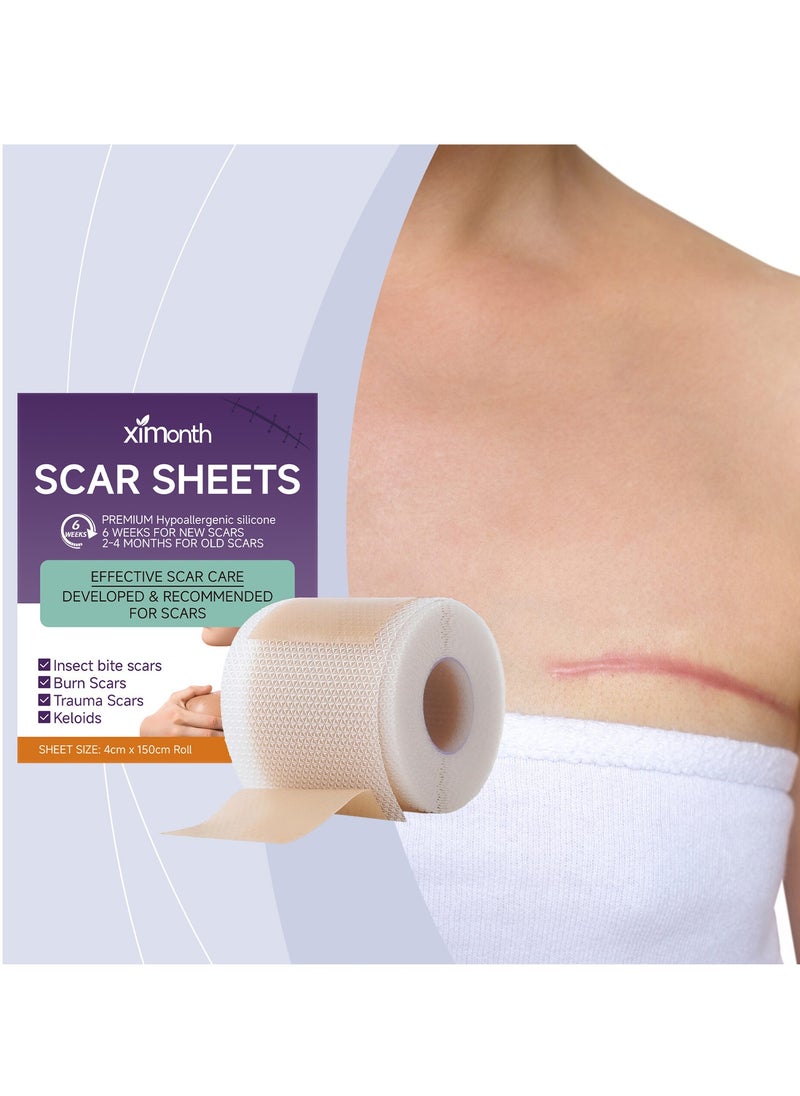 Scar Sheets Effective Scar Care Developed & Recommended for Scars,for C-Section & Keloid Surgery, Burn, Acne - pzsku/Z28F4023D403BE9EEAD95Z/45/_/1740043325/c2b21843-2d6a-4d97-9304-7bbad4d6d080