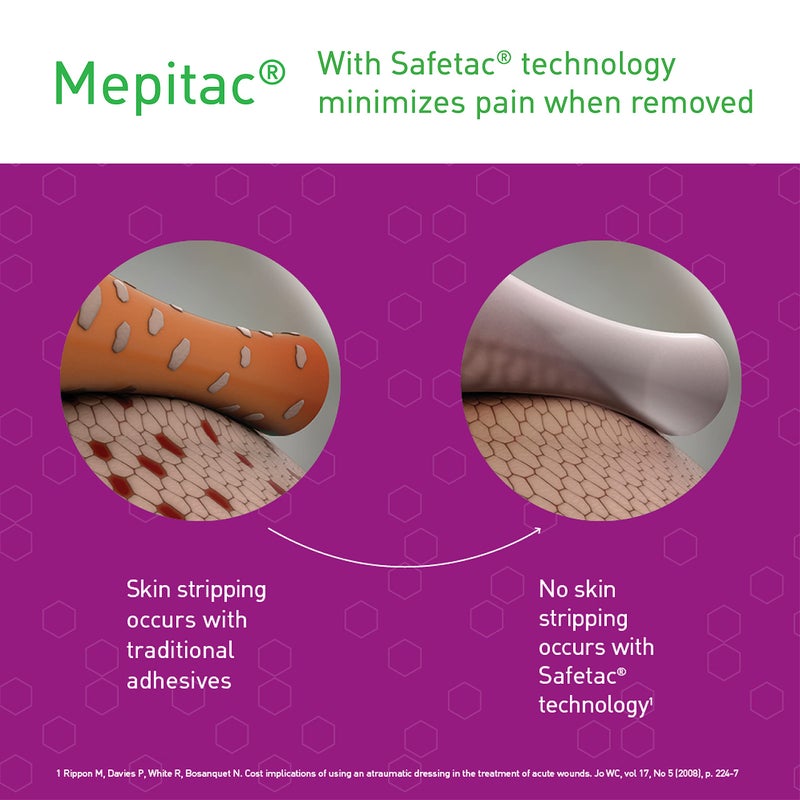Mepitac 298300 Soft Silicone Tape, 2 cm x 3 /0.8 in x 3.3 yd - Image 2