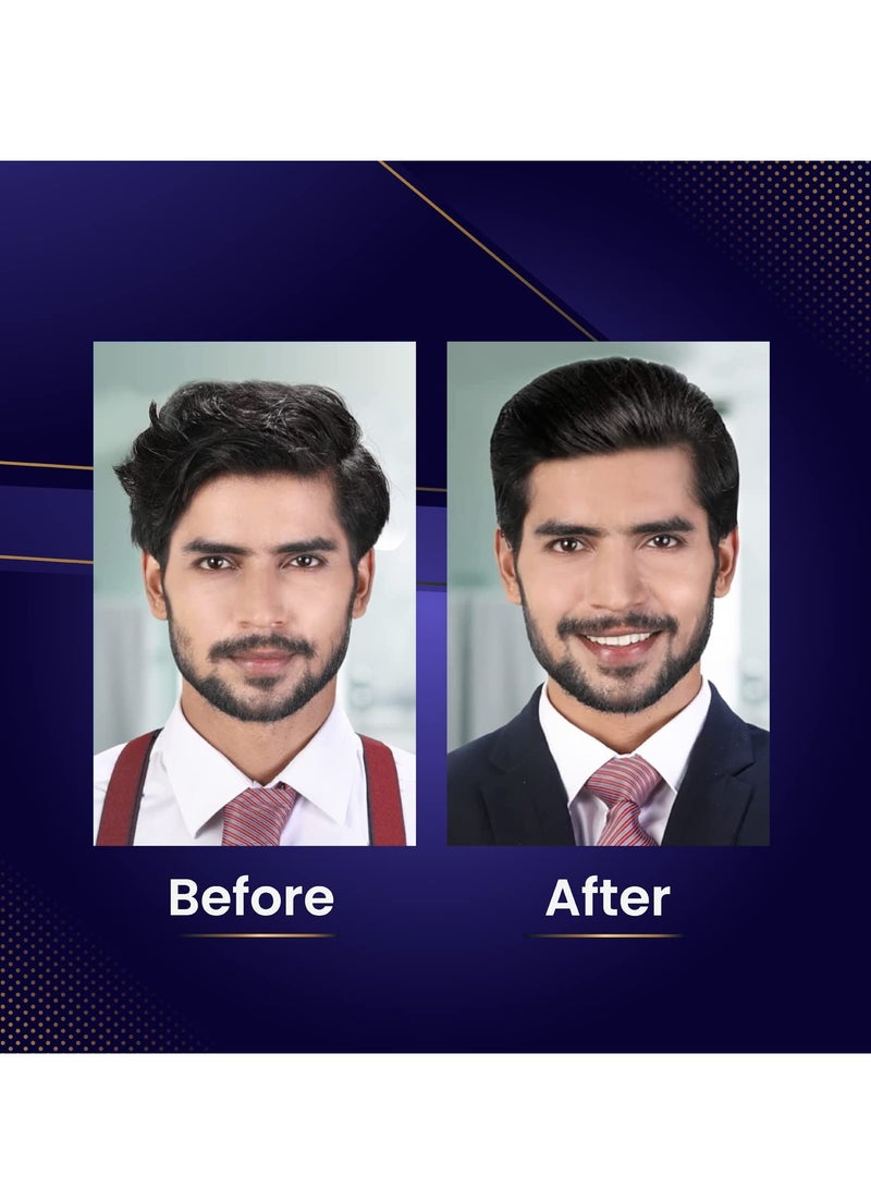 باراشوت كريم الشعر باراشوت أدفانسيد للرجال، 100 مل | مضاد للقشرة | كريم للشعر بعد الاستحمام | كريم شعر بديل الزيت غير لزج - Image 5