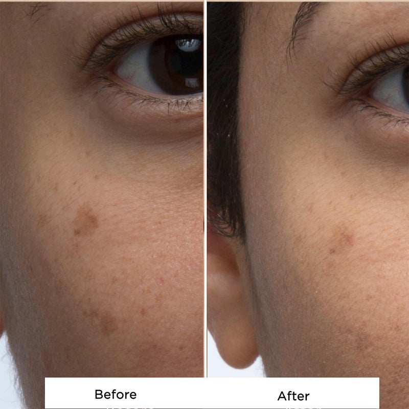 Hey Honey Skincare Propolis Facial Cleanser Foam Formula that Replenishes Skin Barrier | Gentle Face Wash for Oily, Acne-Prone & Sensitive Skin | Natural Ingredients, Non-Comedogenic | 5 oz - Image 4