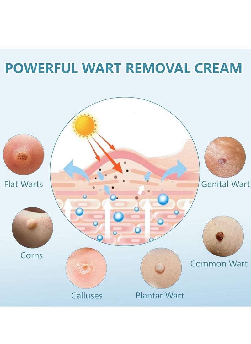 SOUTH MOON Wart Ointment with Salicylic Acid, Wart Remover Freeze, Wart Remover Ointment, Fast Acting Wart Freeze, Wart Remover for Genital Warts, Plantar Warts, Common Warts, Corns, Wart Cream 20g  - Image 4