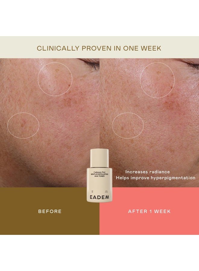 EADEM Gentle Exfoliating AHA & PHA Toner, Exfoliating Face Serum with Tranexamic Acid, AHA Exfoliant & Pore Minimizer for Face and Body, Acne Spot Serum, 5.0 oz, Cashmere Peel - Image 3