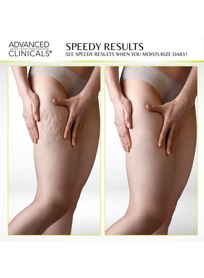 Advanced Clinicals Green Coffee Bean Lift & Slim Body Cream Skin Care Anti Cellulite Cream | Caffeine Body Lotion Balm To Firm, Tighten, & Hydrate Look Of Legs, Arms, Tummy, Butt, & Thighs, 16 Ounce - Image 5