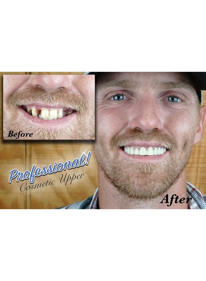 Instant Smile Professional Cosmetic Upper New from Instant Smile Hand Crafted Detail Custom fit at Home Works Best in Medium to Large Sized Mouths - Image 2