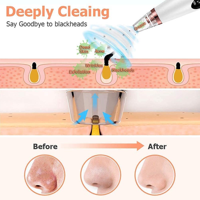 ZIPRON 6 in 1 Multifunction Blackhead Remover Tools Electric Derma suction Machine Acne Pimple Pore Cleaner Vacuum tool Facial Cleanser Device for Nose Skin Care - Image 4