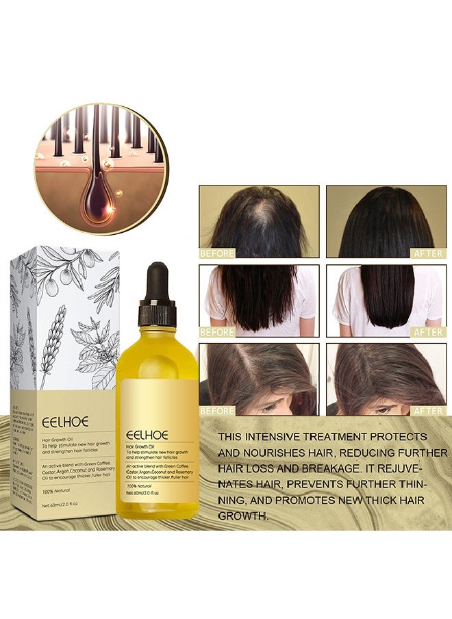 EELHOE - 100% Natural Hair Growth Oil To Help Stimulate New Hair Growth And Streng Then Hair Follicles,with Caffeine, Biotin, Castor Oil, Argan Oil, Coconut Oil, an Effective Hair Mask to Increase Hair Density - Image 1