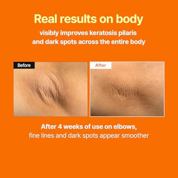 MEDITHERAPY Retinal Skin Booster Serum – Beginner Friendly Non-Irritating Retinaldehyde for Face and Body – Anti-Aging Retinol Pore Minimizer for Blemish Prone Skin– Korean Skin Care, 5.07 Fl.Oz Large - Image 4