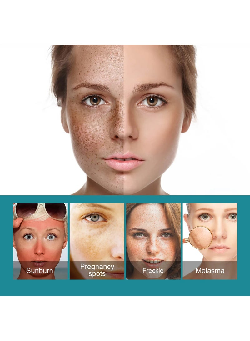 EELHOE Sun Spot Remover for Face, Melasma, Freckle, Age Spots Pigment, Removal, Anti Pigmentation, Blemish, Reducer, Brighten Skin Care Cream - Image 4