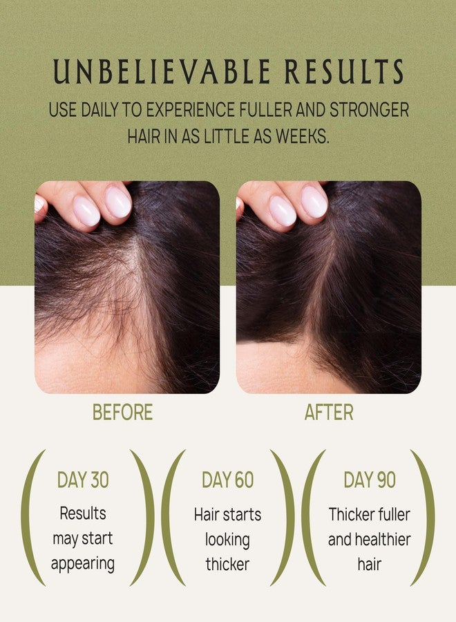 Lebanta Batana Oil Shampoo for Hair Growth - Color Safe Natural Moisturizing Shampoo for Hair Loss & Thinning with Rosemary Oil - Sulfate Free Organic Hydrating Castor Oil Hair Gifts for Women & Men - Image 4