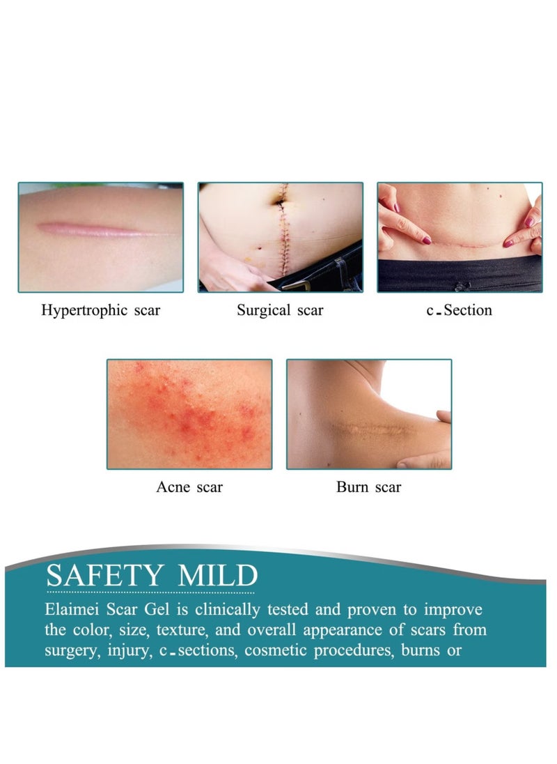 Elaimei - Silicone Scar Tape, Medical silicone scar remover sheet, stretch marks treatment waterproof silicone scar sheet 4cmx1.5m - Image 1