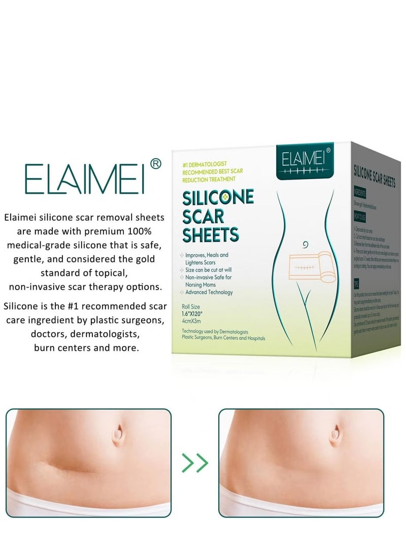 Elaimei - Silicone Scar Tape, Medical silicone scar remover sheet, stretch marks treatment waterproof silicone scar sheet 4cmx1.5m - Image 1